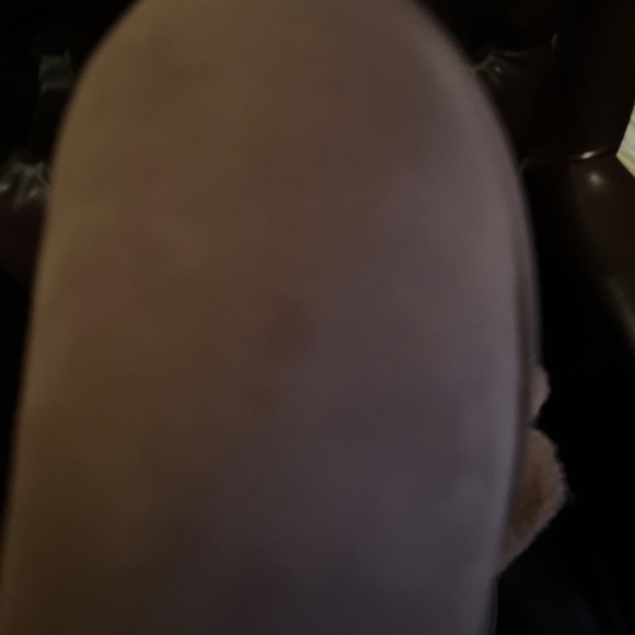 UGG NEW PINK SHEEPSKIN BOOTS 11 - Picture 9 of 12